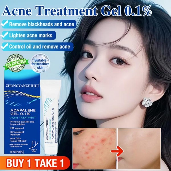 Acne Treatment Gel
