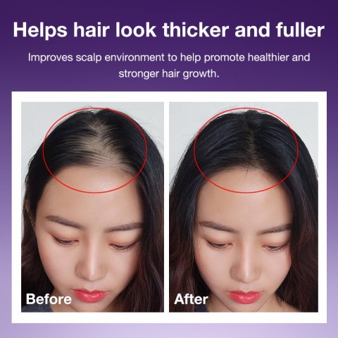 Hair Thickening Roll On Serum