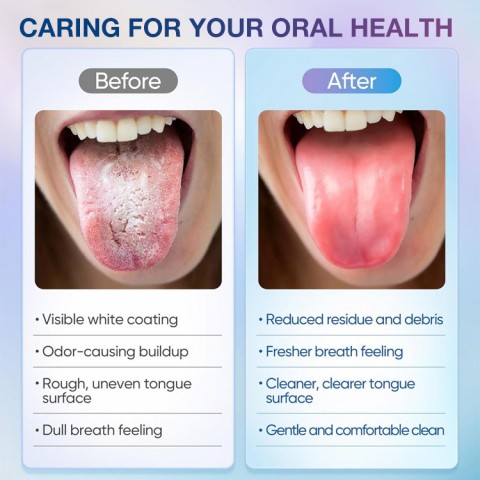 Tongue Cleaner Kit