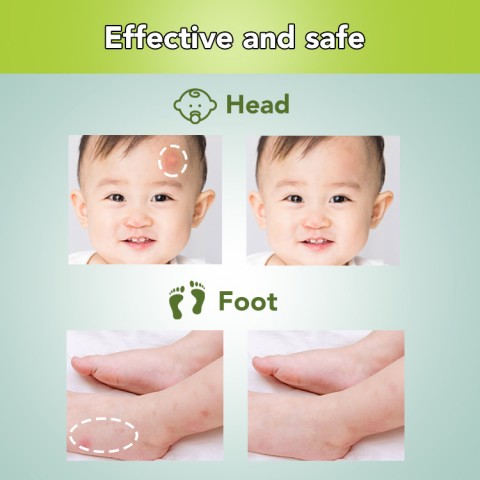 Baby Anti-itching Balm