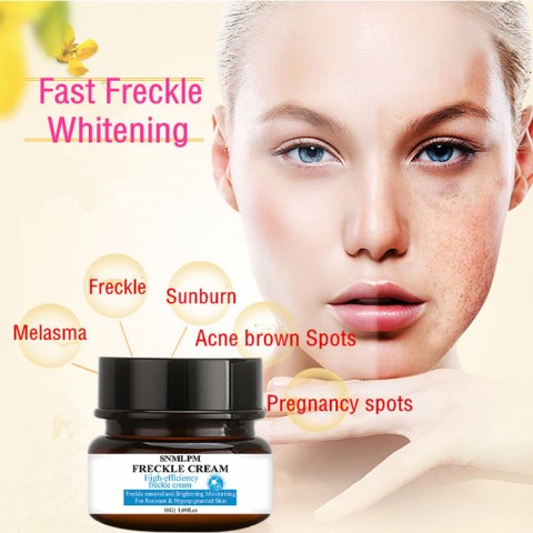 Highlights Chloasma Freckle Removal Cream