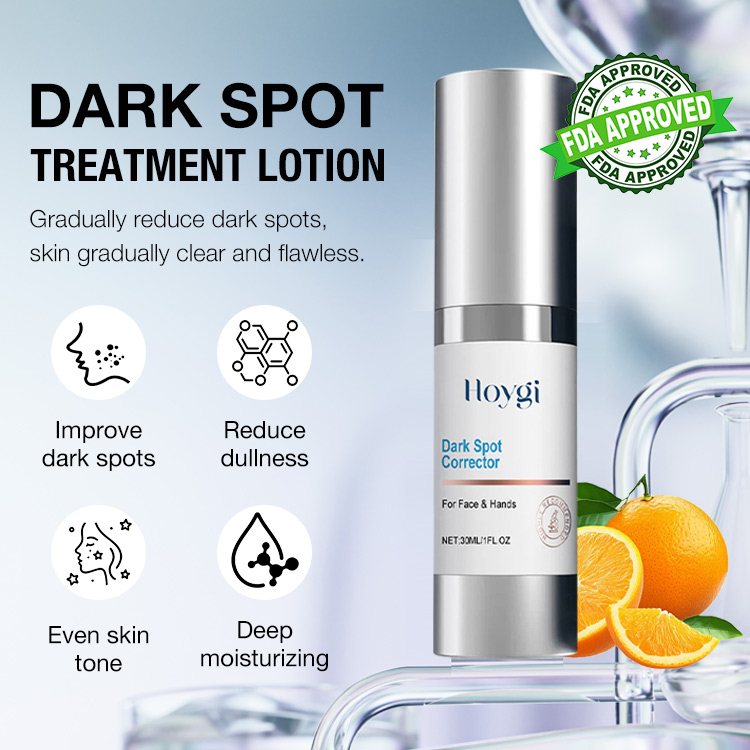 Heroes Day Promotion –Dark Spot Corrector Lotion-“Erase” and fade age spots without harsh chemicals or lasers-Reduce sun spots, dark spots, and hyperpigmentation