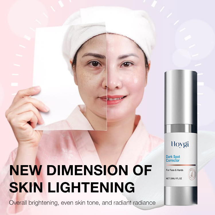 Heroes Day Promotion –Dark Spot Corrector Lotion-“Erase” and fade age spots without harsh chemicals or lasers-Reduce sun spots, dark spots, and hyperpigmentation