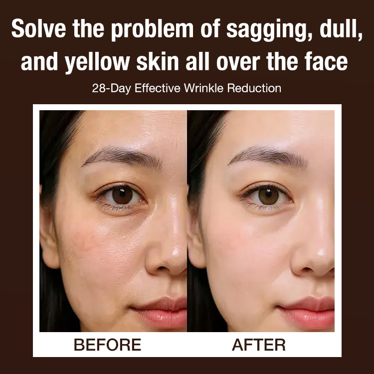 Halloween Sale Free Shipping - Ganoderma lucidum Anti-wrinkle Rejuvenating Serum - Fade fine lines/Deeply repair/Moisturizing & Firming skin - 28-Day Effective Wrinkle Reduction
