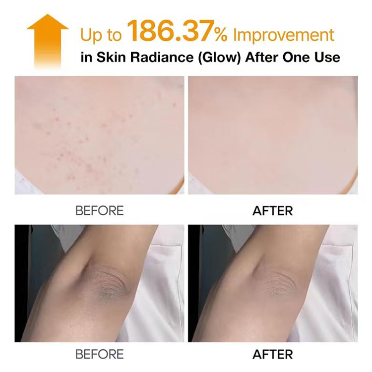 Mid-Year Mega Sale – Buy 1 Take 1 to save 500p -Kojic Acid Turmeric Spray-200ml Pore Clearing Exfoliating Formula Skin Repair Scrub-Fades Dark Spots Fast, Brighten dark neck, underarms and thighs
