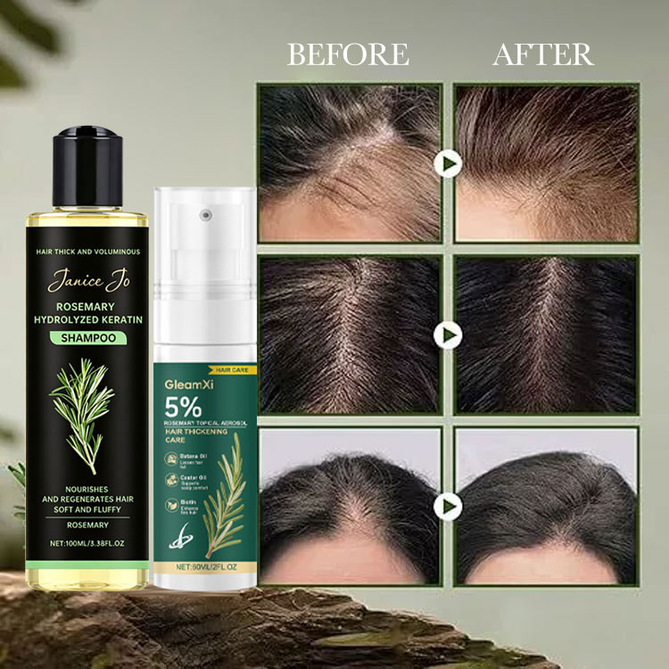 Mid-year promo Buy 1 Take 1 - Rosemary Shampoo and Hair Spray - Boost Hair Growth, Control Oil , Dandruff, Soothe Scalp lritation and Restore Shine