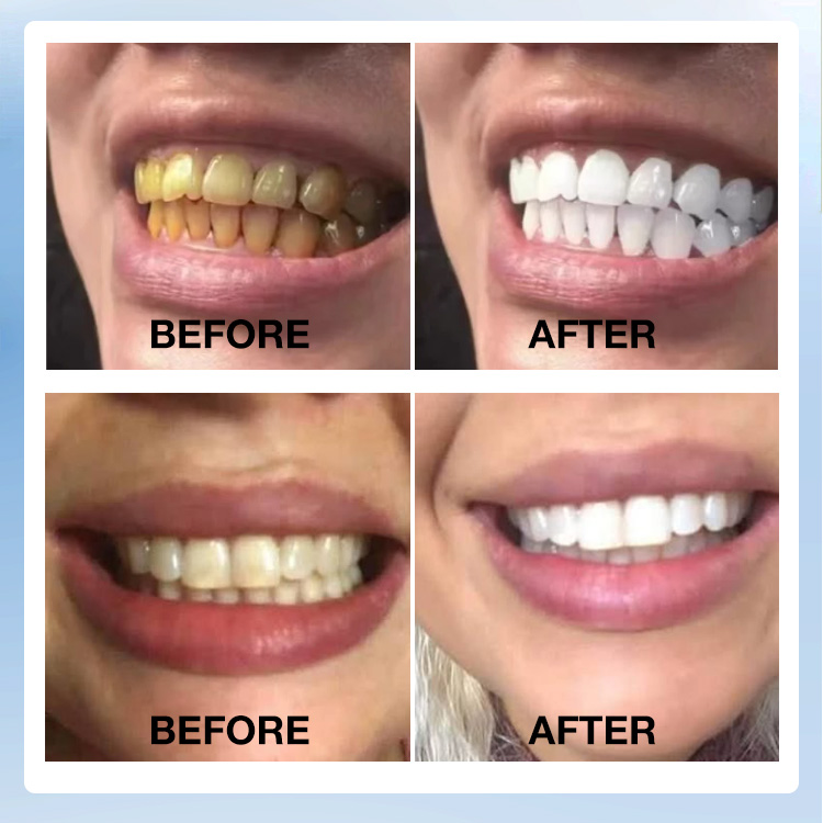 Mid-year Promotion Buy 1 Take 1 – 3 in 1 Stain-Removing Mouthwash - Fresh mouth/Gunk Removing/Promote Whiter Teeth - Refresh mouth in 30 seconds
